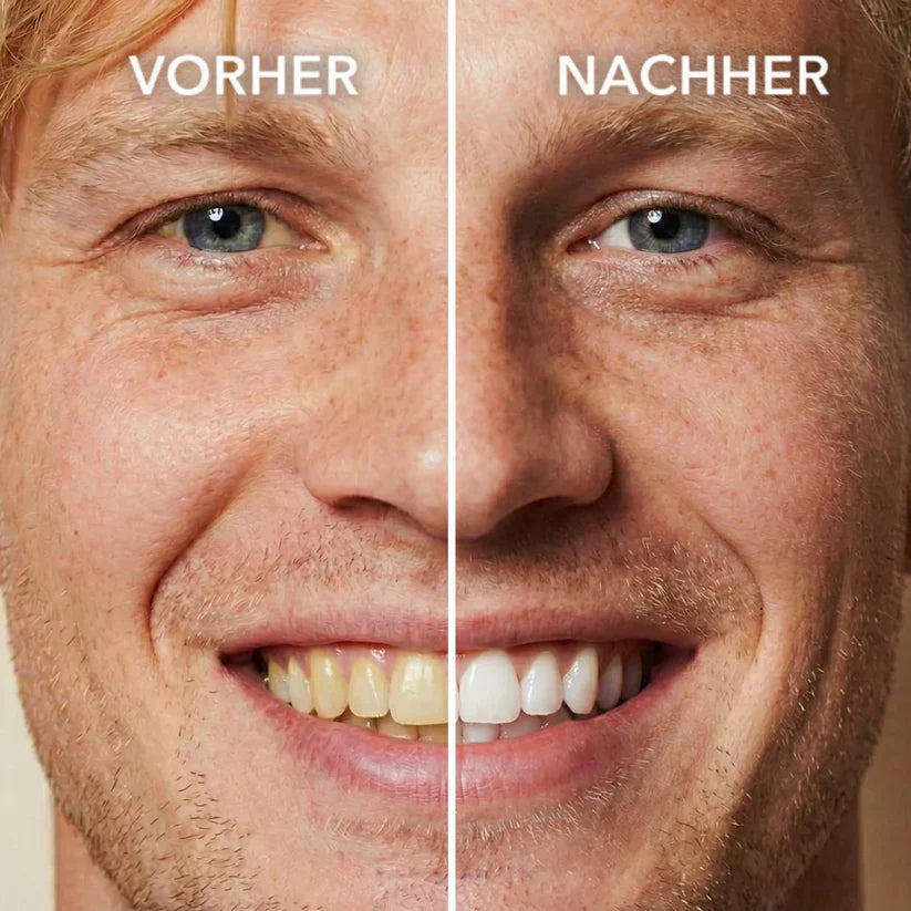 The Brighter Tooth Polish