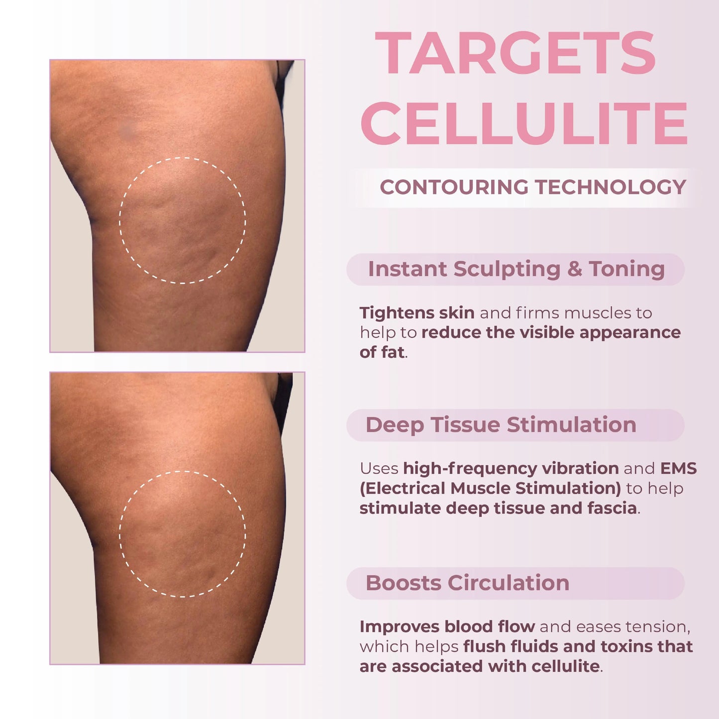 CelluTone Ultra Sculptor
