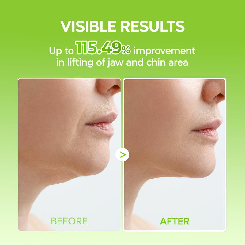 V-Lift Jawline Bands