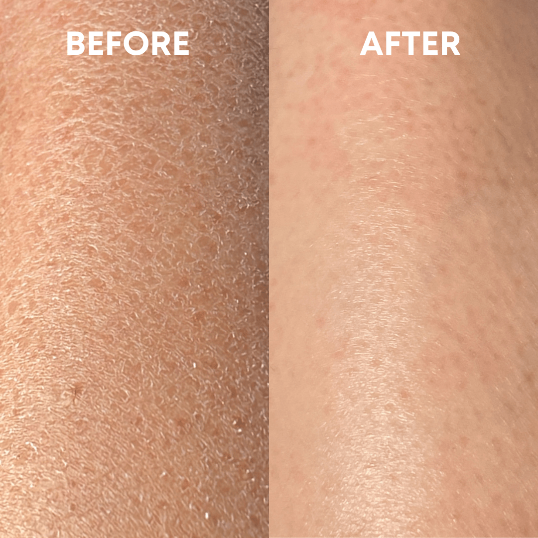 SmoothBuff™ Body Exfoliating Glove