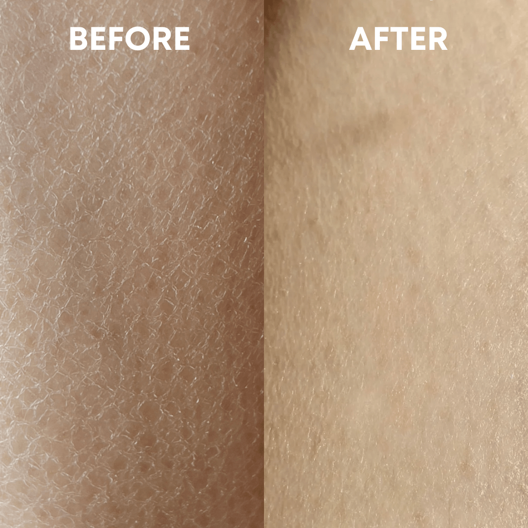 SmoothBuff™ Body Exfoliating Glove